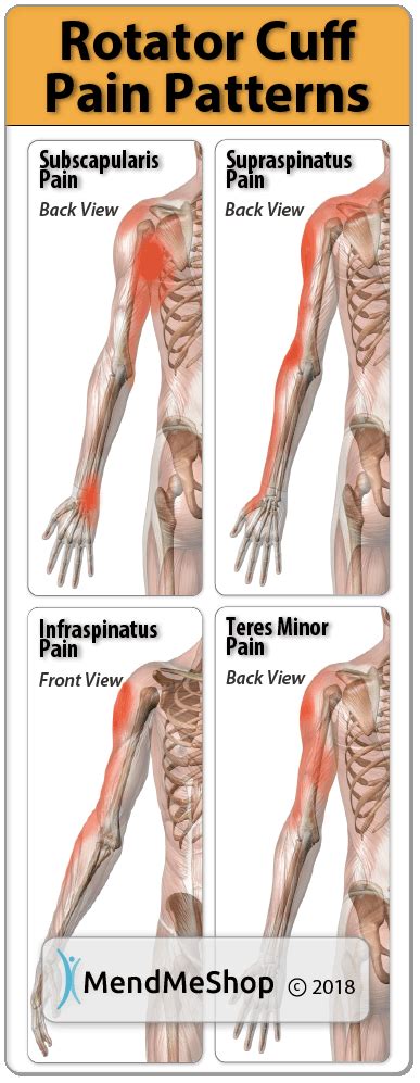 Rotator Cuff Tear Symptoms