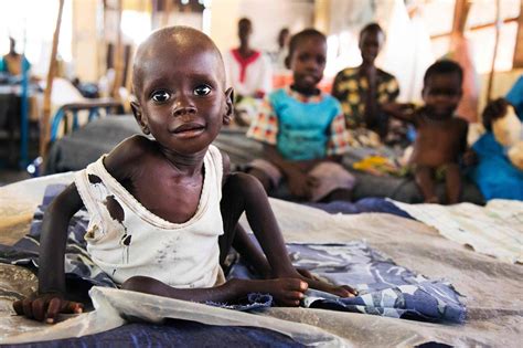 Children fleeing South Sudan war suffer 'severe malnutrition'