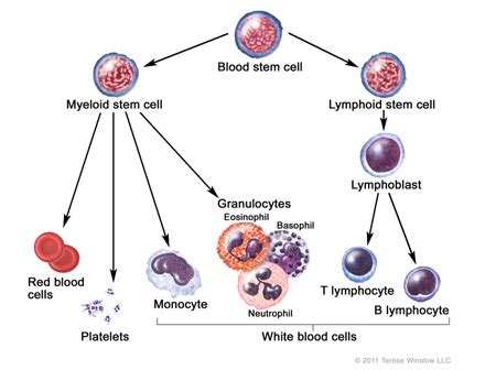 Non-Hodgkin Lymphoma (NHL) in Children | CureSearch