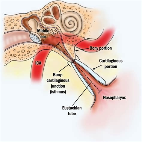 Eustachian Tube Anatomy 1 - Ear & Sinus Institute