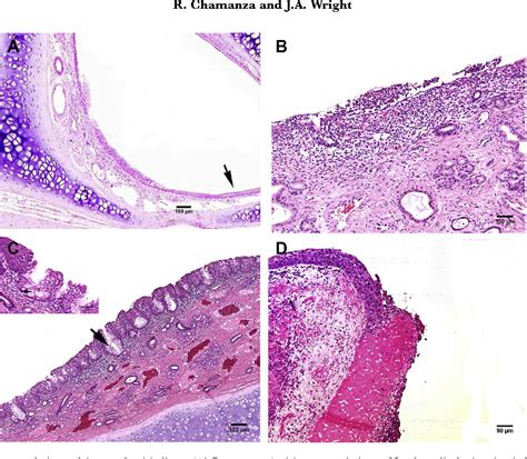 Nasal Turbinate Histology | Porn Sex Picture