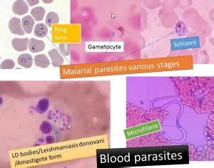 Blood parasites : Introduction, Pathogenecity, Lab Diagnosis and Treat