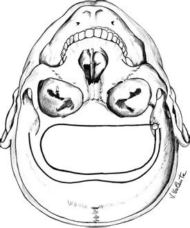 Pituitary Surgery | Clinical Gate