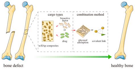 IJMS | Free Full-Text | Nano-Hydroxyapatite Composite Scaffolds Loaded ...