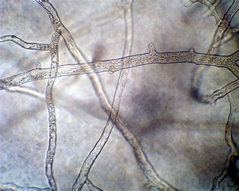 Fungi Hyphae | Medical Laboratories