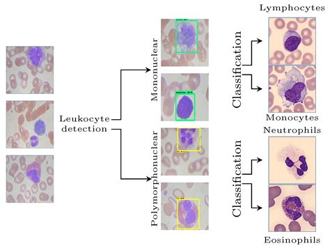 Diagnostics | Free Full-Text | An Efficient Multi-Level Convolutional ...