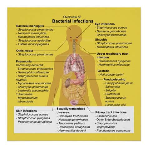 Overview of Bacterial Infections Poster | Zazzle | Bacterial infection ...