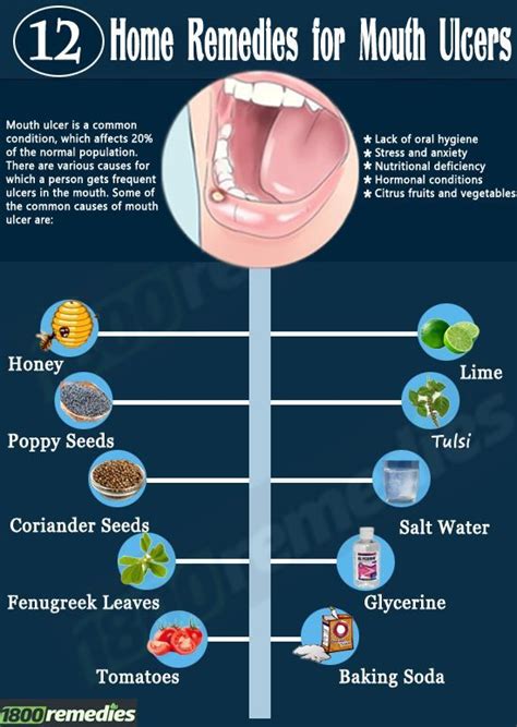 What Causes Mouth Ulcers / Glossitis Treatment In Homeopathy - Homeopathic Medicine ...