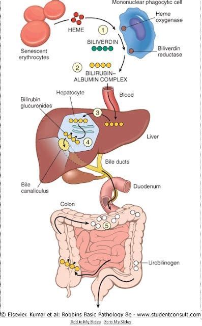 bilirubin metabolism pathway diagrams - Google Search | Medical, Medical knowledge, Nursing ...