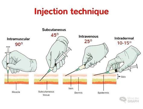 Medical Contents on Instagram: “Injection technique. . . . . . . . . . #surgicalassistan ...