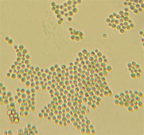 Fun With Microbiology (What's Buggin' You?): Cryptococcus neoformans