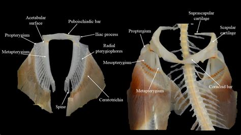 Squalus skeleton | Atlas of Comparative Vertebrate Anatomy