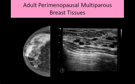 Breast Ultrasound Registry Review Course