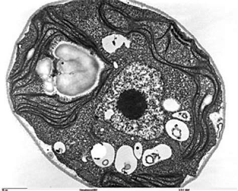 How cells know when it's time to eat themselves