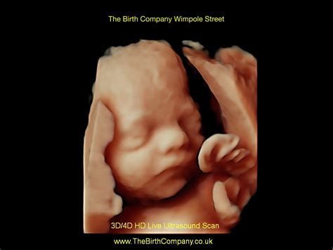 3D/4D HD LIVE Scan: A Fascinating Peek at Your Baby's Development"