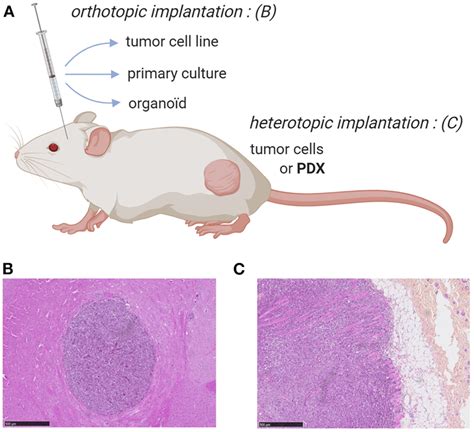 | Mouse models for ortho-or heterotopic administrations of human tumor... | Download Scientific ...