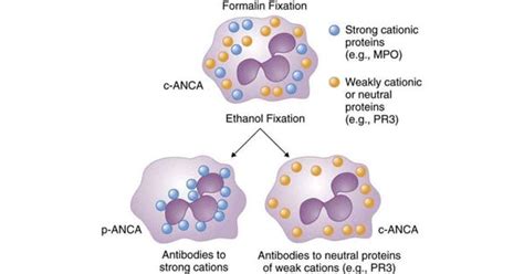 Anti-Neutrophil Cytoplasmic Antibody (Anca) - www.medicoapps.org