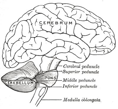 Cerebellar hypoplasia - Wikipedia