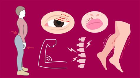 Preventing Musculoskeletal Disorders: Strategy to a Healthy Body