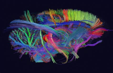 Project Underway: The First 3D Map of the Brain's Connections - Neatorama