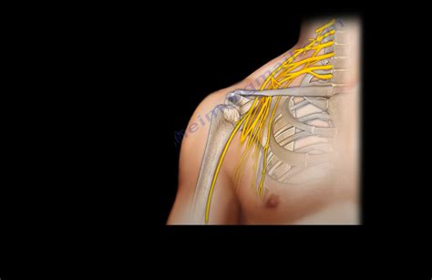 Anatomy and Divisions of the Brachial Plexus — OrthopaedicPrinciples.com