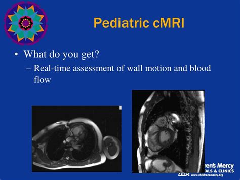 PPT - State of the Art: Pediatric Cardiac MRI PowerPoint Presentation ...