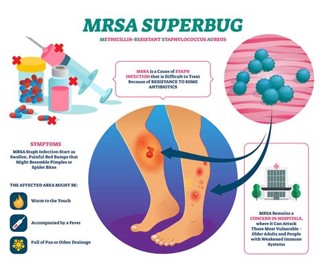 MRSA Infections in Nursing Homes & Care Living Facilities
