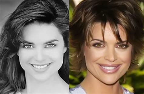 Lisa Rinna before and after plastic surgery 03 – Celebrity plastic surgery online