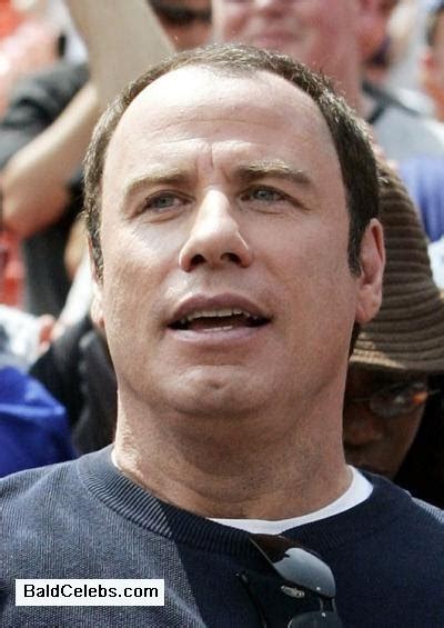 BaldCelebs.com: John Travolta (Actor) Status: Balding