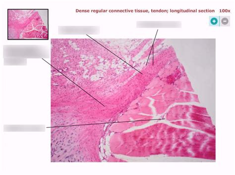 Dense regular connective tissue, tendon; longitudinal section Diagram | Quizlet