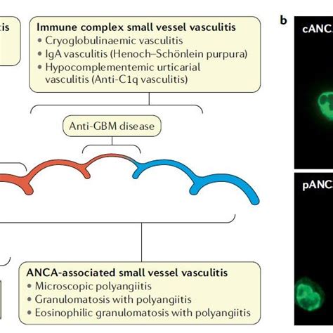 | Small vessel vasculitis. a | The updated 2012 Chapel Hill Consensus ...