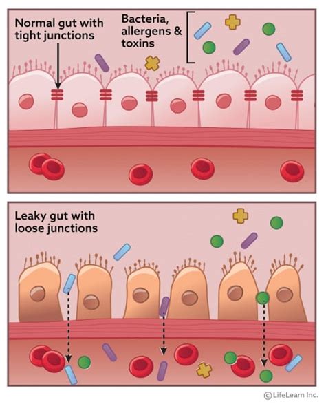 What Causes Intestinal Bacterial Infections In Dogs