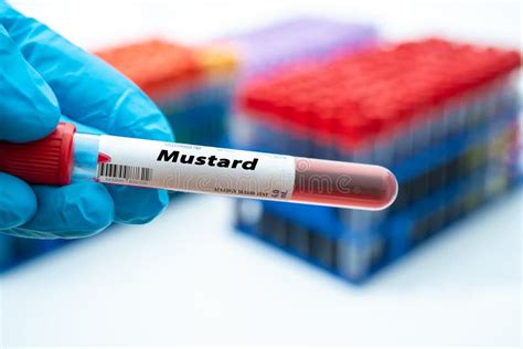 Mustard Allergy Blood Test. Test Tube in Doctor Hand Stock Image - Image of research, allergy ...