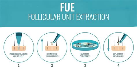 Best Follicular Unit Extraction in Toronto,ON | FUE Canada