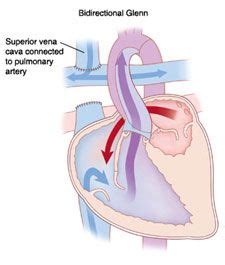 Pediatric Heart Disease, Nursing Notes, Nursing School, Np School ...