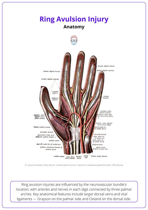 Ring Avulsion Injury: Mechanisms, Classification, & Management