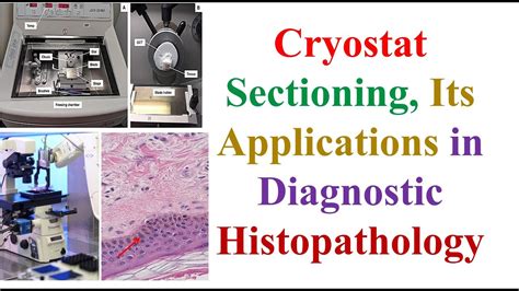 Cryostat Sectioning, Its Applications in Diagnostic Histo, (5th, MLS, -HISTOTECHNOLOGY – 2 ...