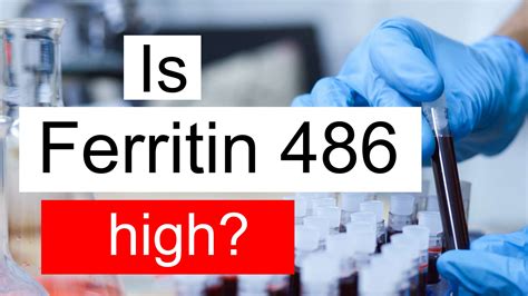 Is Ferritin 486 high, normal or dangerous? What does Ferritin level 486 mean?