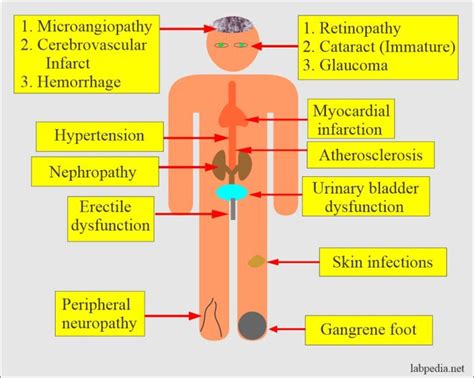 Diabetes mellitus complications and management