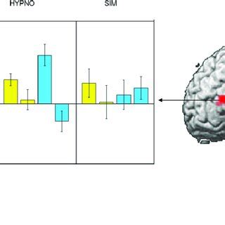 Changes during Motor Response and Inhibition under Hypnosis | Download Scientific Diagram