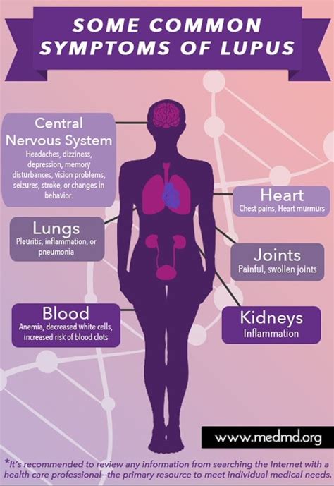 12 Early Symptoms of Lupus | Lupus facts, Lupus nephritis, Lupus symptoms