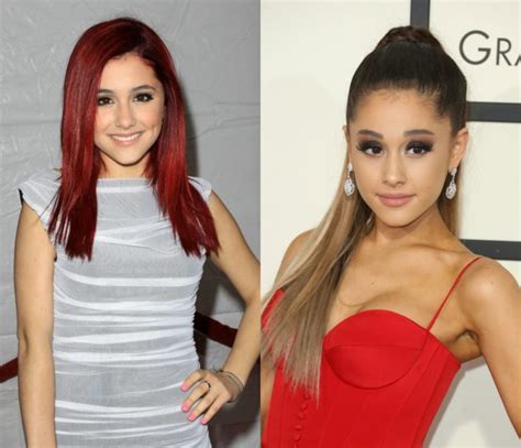 Ariana Grande Before & After: The Power of Plastic Surgery! - Demotix.com