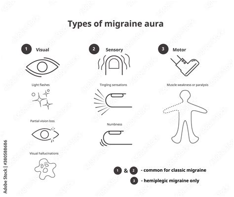 Types of migraine aura. Sensory, visual and motor aura of the classic ...