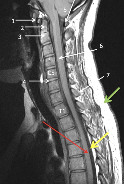 Sagittal neck MRI Diagram | Quizlet