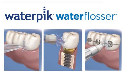 Waterpik Water Flosser now available from Tesco - British Dental Nurses' Journal