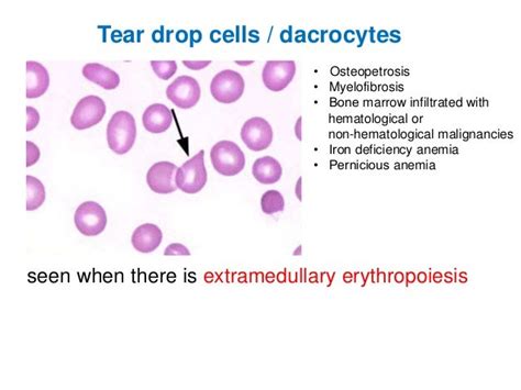 05 peripheral blood smear examination