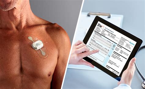 Easy EKG Interpretation: Zio Cardiac Monitoring