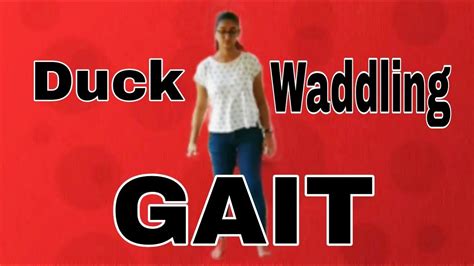 Waddling Gait || Duck Waddling Gait - YouTube