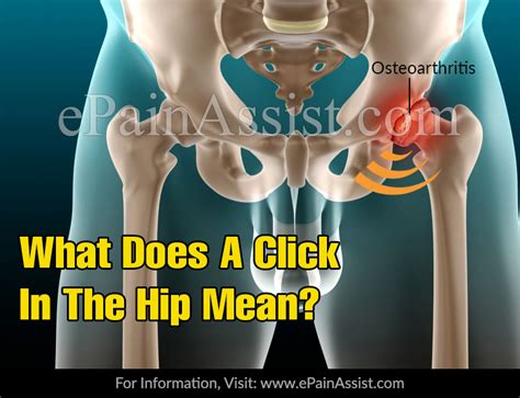 What Does A Click In The Hip Mean?