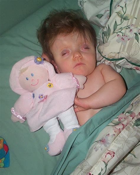 Maggi Blair - News & Updates: Maggi Diagnosed with Trisomy 9 Moisaic Syndrome